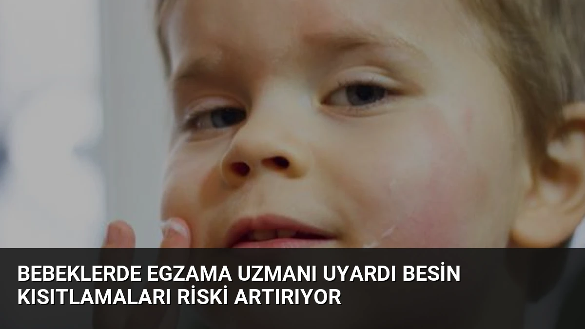 Bebeklerde Egzama Uzmanı Uyardı Besin Kısıtlamaları Riski Artırıyor