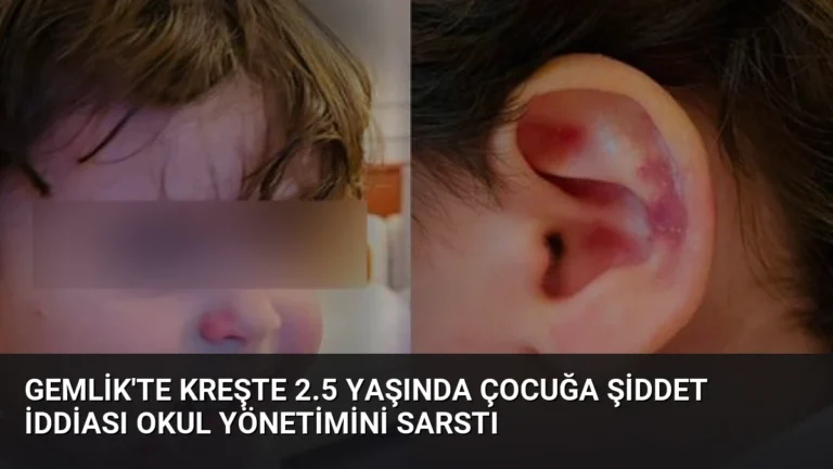 Gemlik’te Kreşte 2.5 Yaşında Çocuğa Şiddet İddiası Okul Yönetimini Sarstı