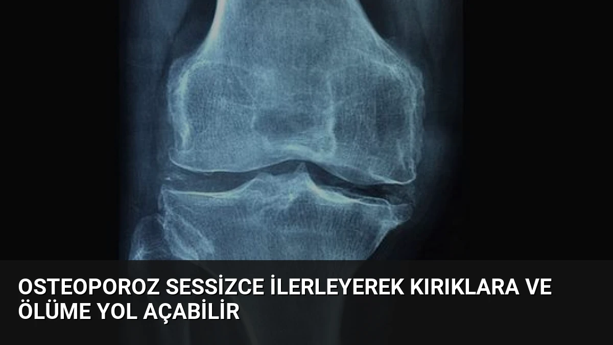 Osteoporoz Sessizce İlerleyerek Kırıklara ve Ölüme Yol Açabilir