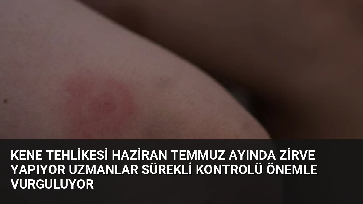 Kene Tehlikesi Haziran Temmuz Ayında Zirve Yapıyor Uzmanlar Sürekli Kontrolü Önemle Vurguluyor