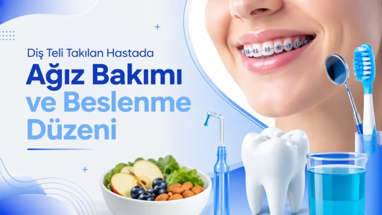 Diş Teli Takılan Hastada Ağız Bakımı ve Beslenme Düzeni